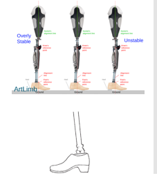 <p>Knee instability </p>