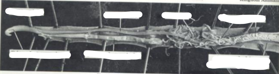 <p>What is this parasite and what are the structures </p>