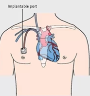 term image