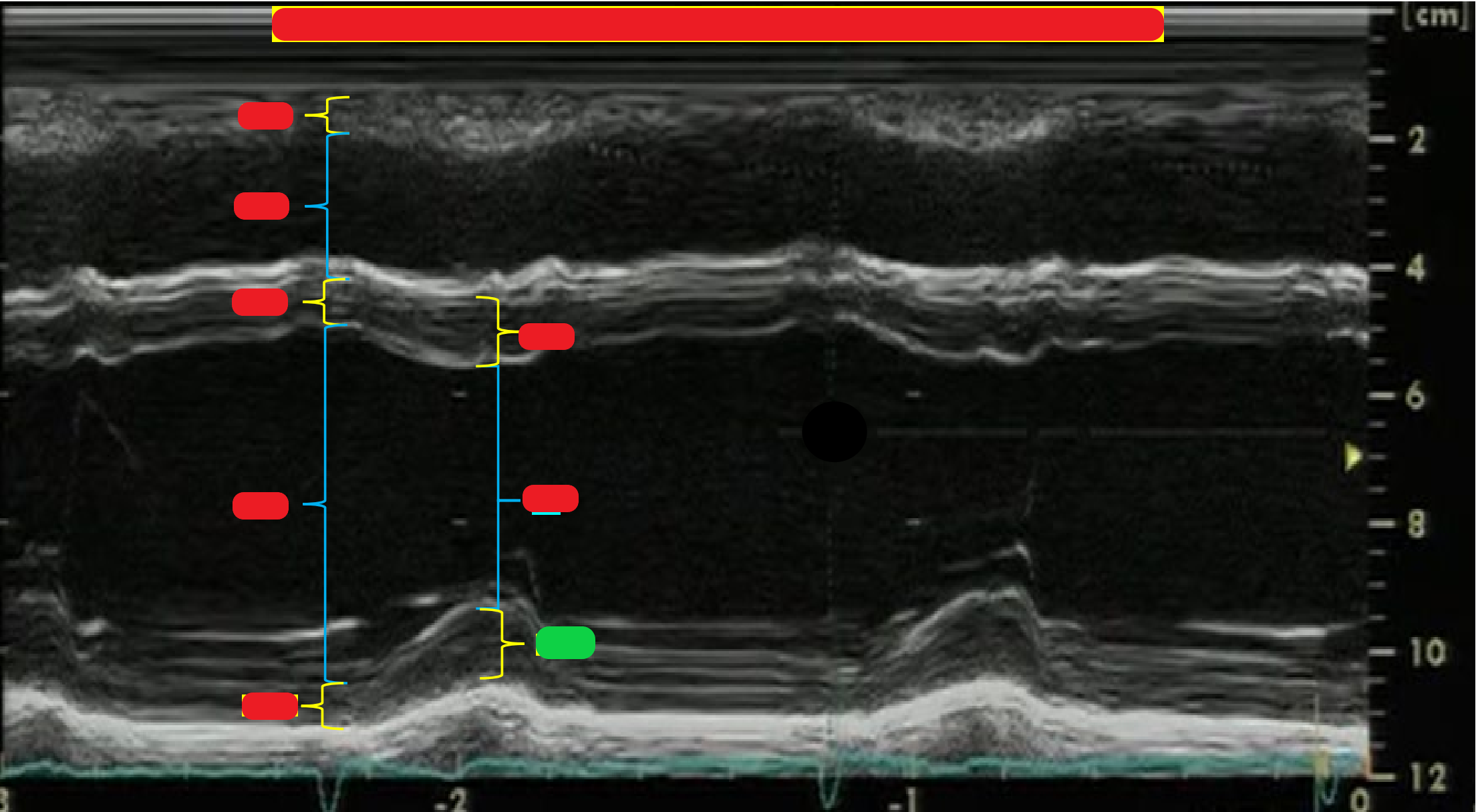 <p>What is highlighted in green?</p>