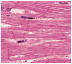 <p>- striated </p><p>- involuntary</p>