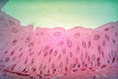 <p>dome-shaped apical surface, variable shapes whether stretched or relaxed; nuclei extends from basement membrane to apical surface</p>