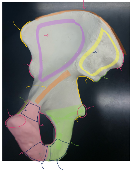 <p>Yellow bottom right</p>