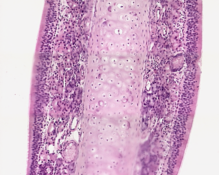 <p>El tracto respiratorio tiene una estructura con epitelio pseudoestratificado cilíndrico ciliado y epitelio estratificado plano en ciertas areas, más aparte glándulas sebáceas y seromucosas, hueso y cartilago hialino, como se le conoce a esta estructura anatomica:</p>