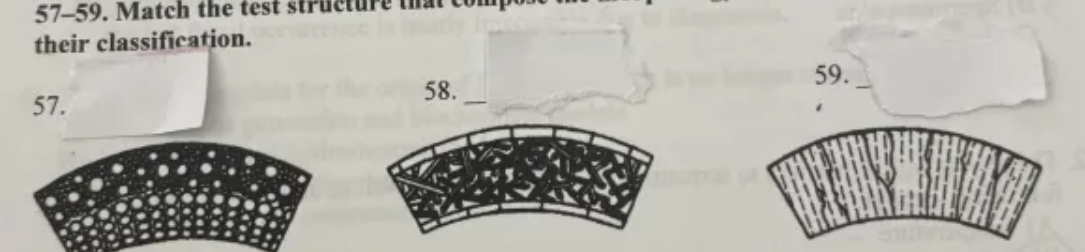 <p>a. agglutinated </p><p>b. hyaline radial </p><p>c. microgranular compound </p><p>d. porcellanious </p>