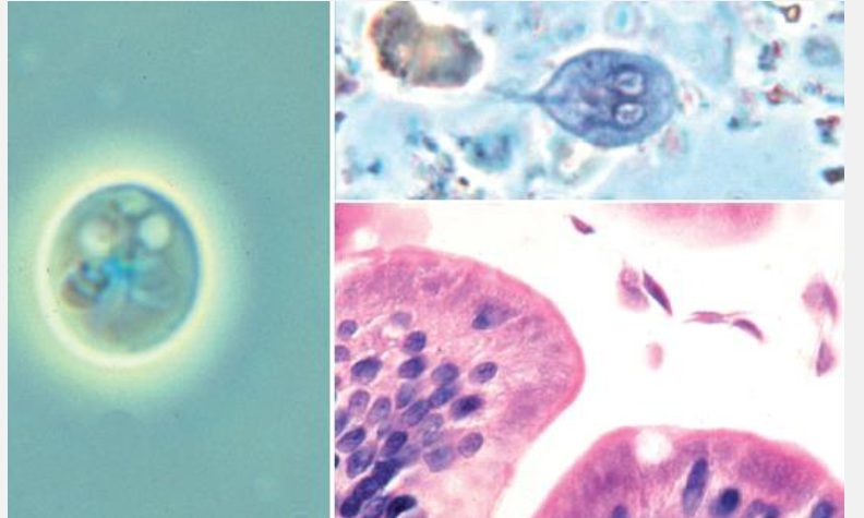 <p><span style="color: blue;"><em>Giardia</em></span>: what life cycle stage is infectious and not infectious?</p>
