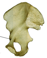 <p>Name this groove </p><p>line when it is now only over the pubis</p>