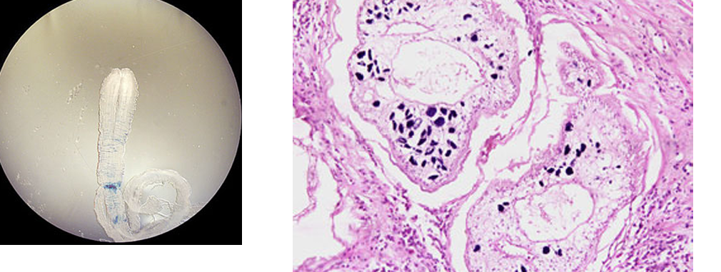 <p>Pseudophyllidian tapeworm w/ aquatic lifecycle and 2 intermediate hosts</p>