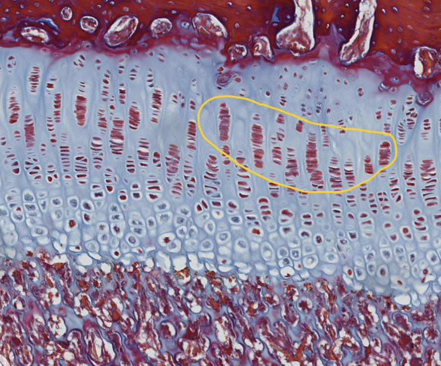 <p>Layers of the physis: which specific zone is encircled?</p>