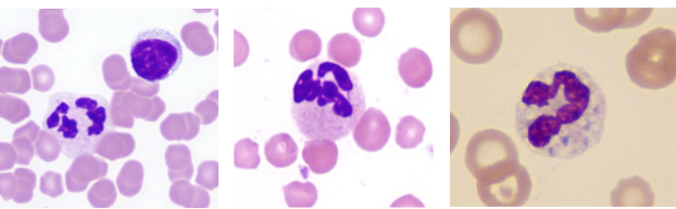 <p>function of neutrophils</p>