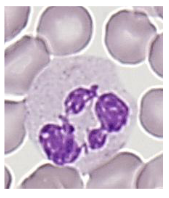 <p>- Reduction in size during differentiation</p><p>.</p><p>Contain fine granules (azurophilic)</p><p>- Primary and secondary (specific) cytoplasmic</p><p>- Contain enzymes involved in "killing"</p><p>.</p><p>- Neutrophil nucleus segments (2 -5 segments); females have drumstick-like appendage (20%)</p><p>- Neutrophil migrates to tissue</p><p>- 9-15 micrometre diameter</p><p>- Phagocytic function</p><p>.</p><p>- dont stay in the blood for too long, they have transient function because their role is to phagocytose and remove invading pathogens and organisms</p>