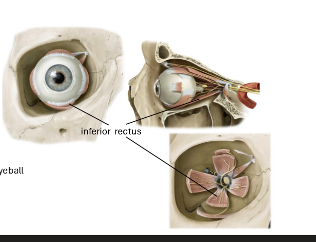 <p>Extorsion of eyeball</p><p>Depression of eyeball</p><p>Adduciton of eyeball</p>