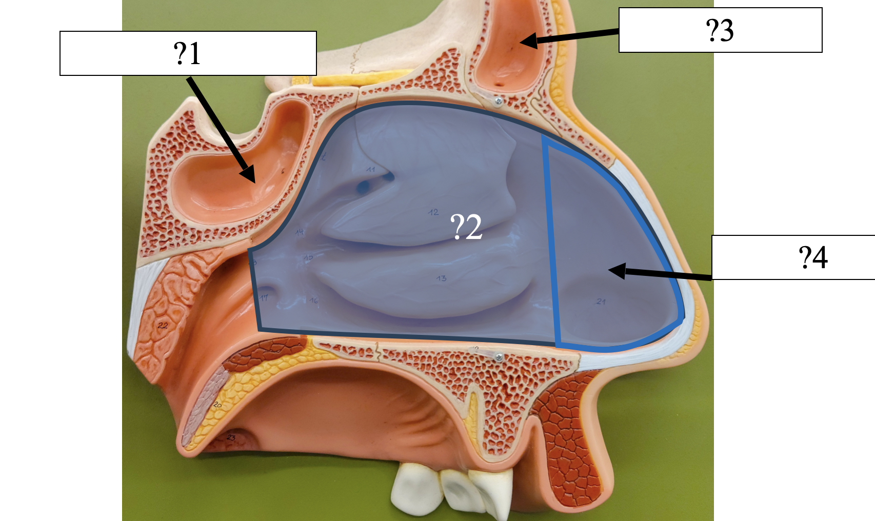 <p>2 Name the entire structure?</p>
