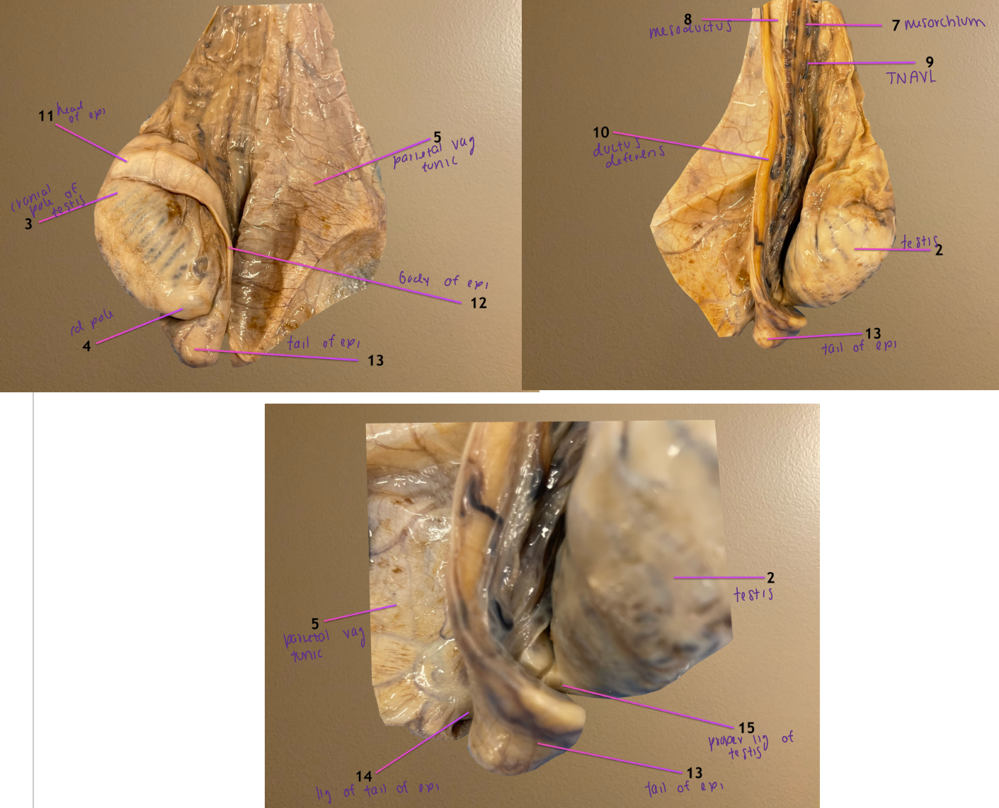 <ol start="10"><li><p>ductus deferens</p></li><li><p>head of epididymis: attached to cranial pole of testis</p></li><li><p>body of epididymis</p></li><li><p>tail of epididymis: transitions into 10</p></li></ol><p></p>