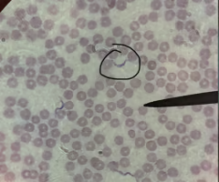 <p>• predatory heterotrophs and parasites</p><p>• termine flagellates in termite guts help digest cellulose</p><p>• trypanosoma bruceii: sleeping sickness; can cause Chagas' disease, heart failure, and blood sucking insects</p><p>• single, large mitochondrion with kinetoplast (mass of DNA0</p><p>• feed on prokaryotes, protists, and plants</p>