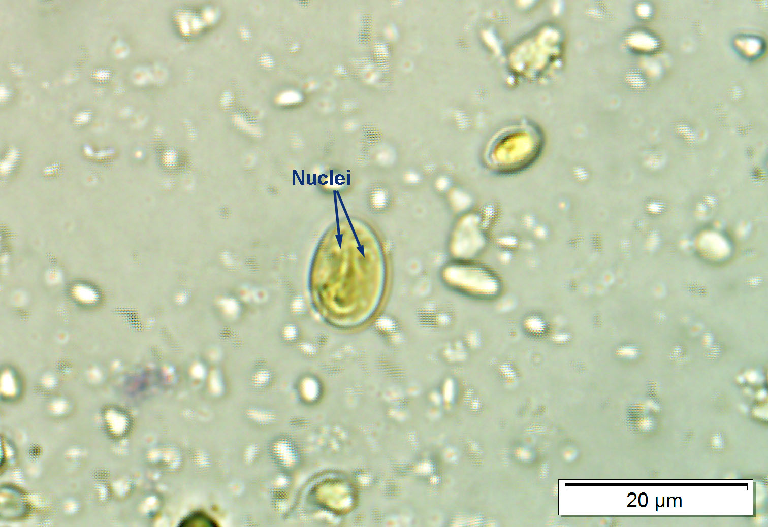 <p>- Ovoid to ellipsoid</p><p>- 11-14 μm (range: 8-19 μm).</p><p>- <strong>Immature cysts = 2 nuclei vs. mature cysts with 4 nuclei</strong></p><p>- Intracytoplasmic fibrils visible</p>