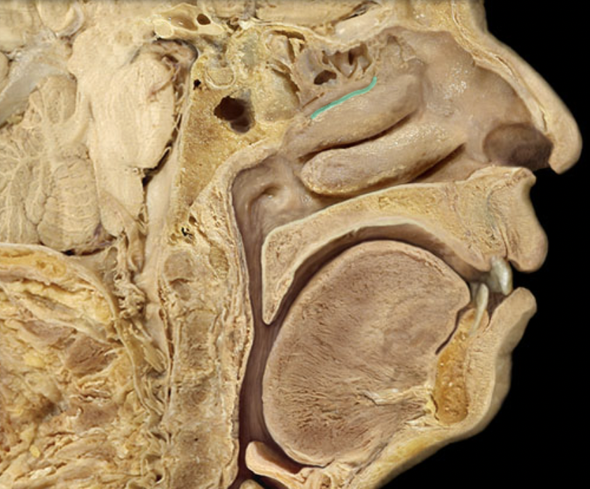 <p>Identify the feature of the nasal cavity</p>