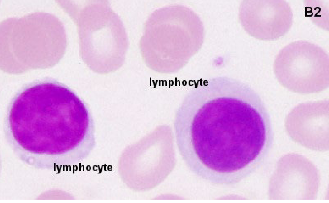 <ul><li><p>Lymphocytes are generally the smallest of all the WBCs → usually a tad larger than RBCs</p></li><li><p>Round nucleus &amp; very little cytoplasm</p></li><li><p>Few to no granules</p></li><li><p>Two main types → B and T lymphocytes (indistinguishable microscopically)</p></li><li><p>Third Type is Killer T Cells</p></li><li><p>The function of T cells and B cells is to identify “non-self” antigens, particularly on viruses</p></li></ul><p></p>