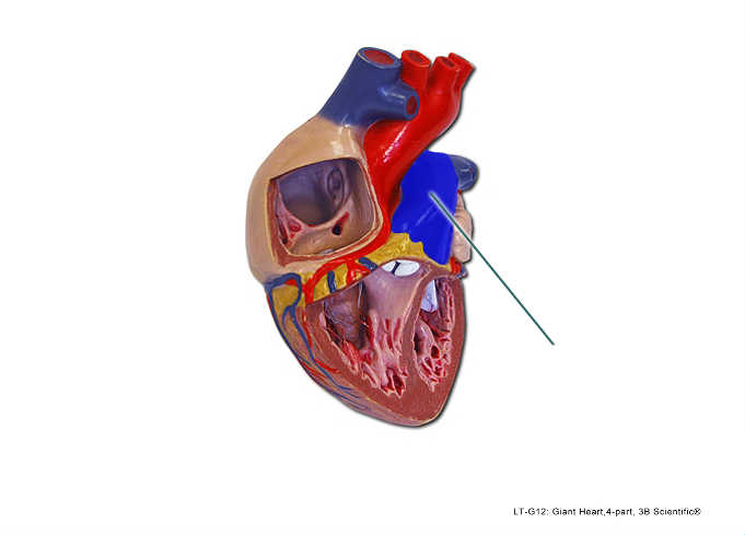 <p>Identify the highlighted vessel.</p>