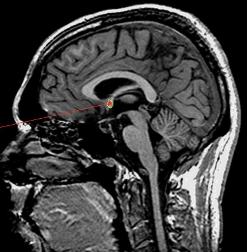 <p>What is the area highlighted called?</p>