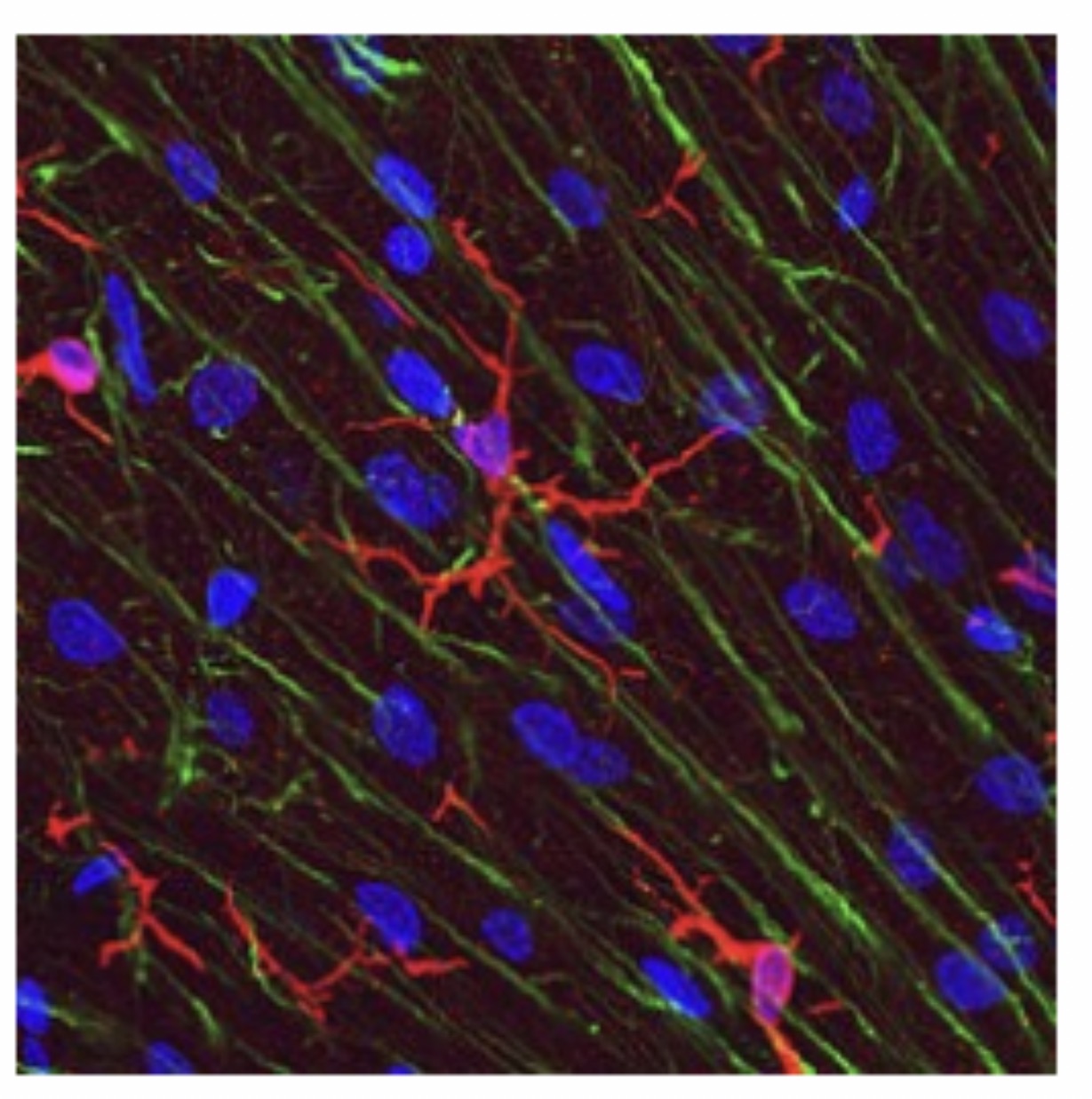 <p>Microglia Cell: Function: <span>Act as CNS immune cells; remove debris and pathogens. Small cells with elongated bodies, elongated nuclei with dense chromatin </span></p>