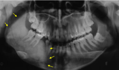 <p>Describe the periphery/borders of the lesion:</p>