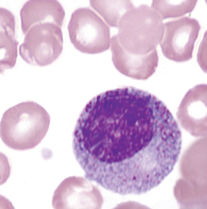 <p>What WBC precursor is this?</p>