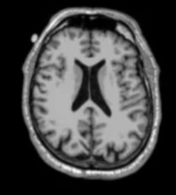 <p>What does a T1-weighted MRI measure?</p>