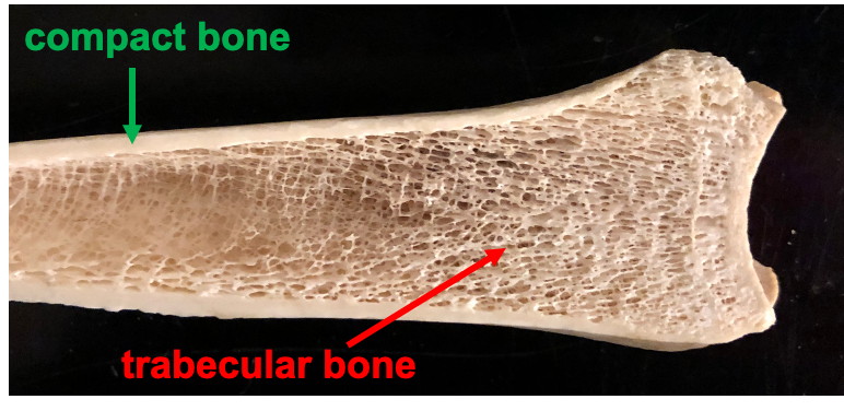 <p>Cortical (compact) bone</p>