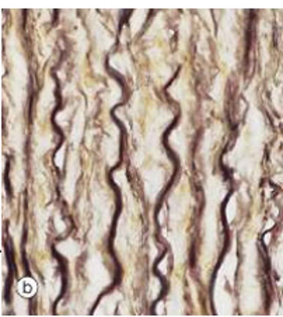<p>Identify the type of vessel</p>