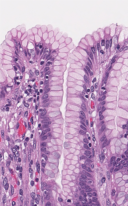<p><span style="font-family: "Calibri Light";">Which type of epithelium lines the surface of this tissue?</span></p>