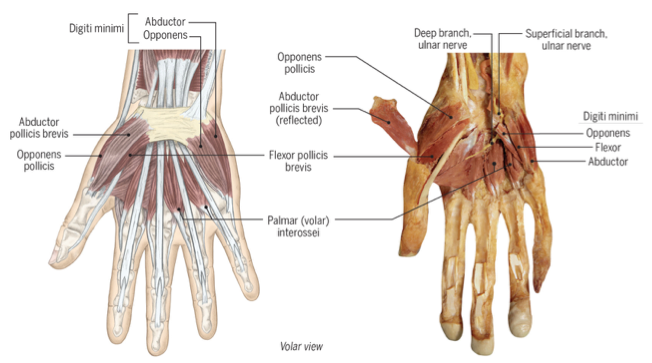 <p><span><em>Thenar muscles</em></span></p><p style="text-align: left;"><span><em>Hypothenar muscles</em></span></p><p style="text-align: left;"><span><em>Palmar interossei</em></span></p><p style="text-align: left;"><span><em>Dorsal interossei</em></span></p><p style="text-align: left;"><span><em>Adductor pollicis</em></span></p><p style="text-align: left;"><span><em>Lumbricals</em></span></p>