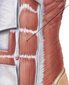 <p>rectus abdominis</p>
