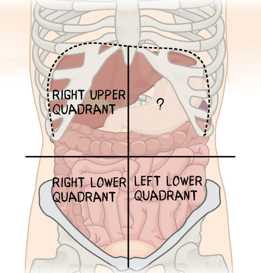 <p>Which abdominopelvic quadrant is missing?</p>