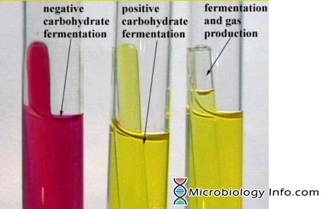 <p>Glucose, Lactose, and Mannitol fermentation tests</p>