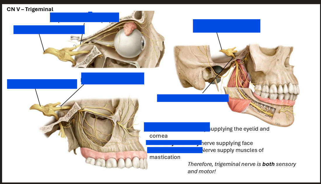 <p>Label the trigeminal nerve</p>