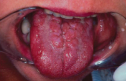 <p>what is this condition</p>