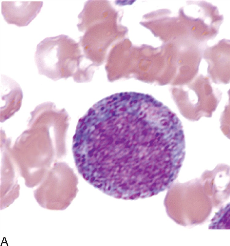 <p>what is a promyelocyte?</p>