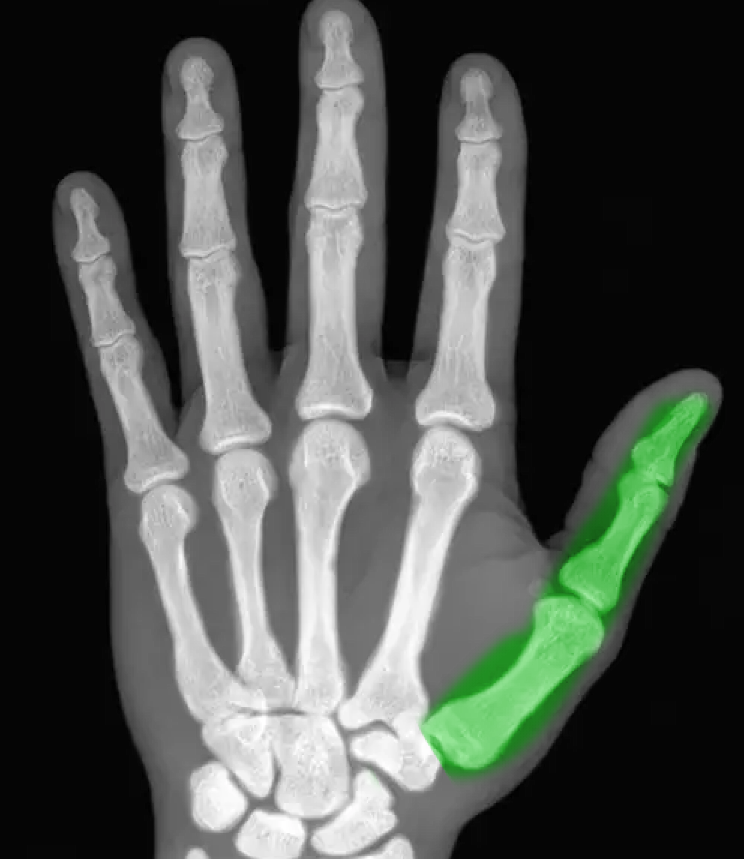 <p>What numeral corresponds to the bones highlighted in green?</p>
