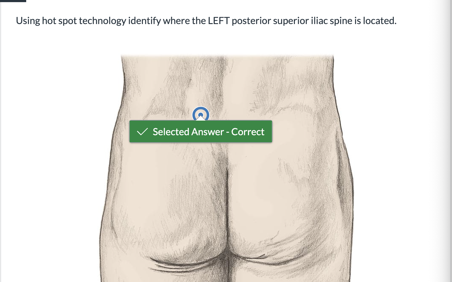 <p><span>Using hot spot technology identify where the LEFT posterior superior iliac spine is located.</span></p>