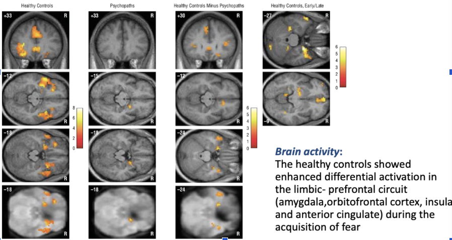 <ul><li><p>healthy controls show a lot of activity in certain areas of the brain </p><ul><li><p>limbic and frontal structures are very active </p></li></ul></li><li><p>for psychopaths, this is not shown </p></li><li><p>it is the composition of info that travels across the brain that is affected, not just one area </p></li></ul><p></p>