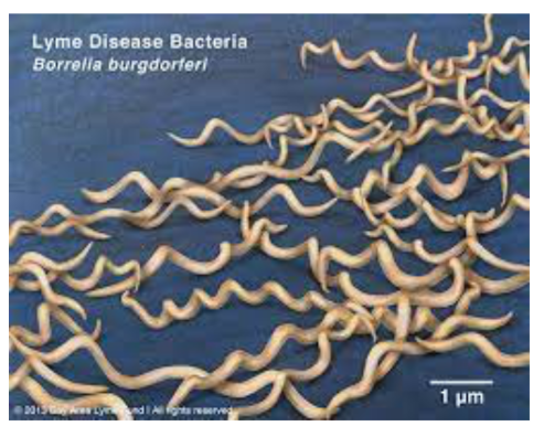 <p>The spirochete Borrelia burgdorferi is a tick-borne parasite responsible for Lyme disease in humans!</p><p>Blacklegged ticks are often carriers of <em>Borrelia burgdorferi</em></p><p>An infected tick may transmit Lyme Disease during the act of attaching and biting their host</p>