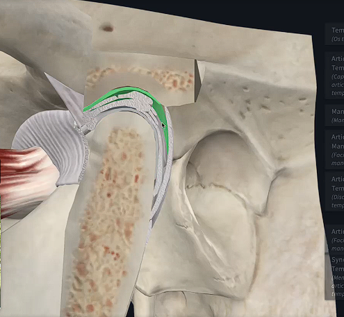 <p>In the TMJ, what cavity is this?</p>