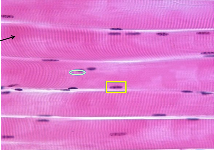 <p>“Hot dog” shape</p><p>nuclei stained dark by periphery</p><p>Longitudinal lines: are striations made by myofibrils (myosin and actin filaments aligned in sarcomere)</p><p>Endomysium (white separations</p>