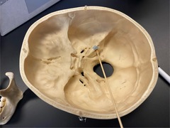 <p>Name the structure in blue (not the stick - above the stick)</p>