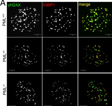 <p>While yH2Ax and 53BP1 still appear, with no PML, we lose the perfect correlation that we had when PML was present. Organization of repair foci is disrupted, meaning the DNA ends are less coordinated, and repair becomes less efficient </p>
