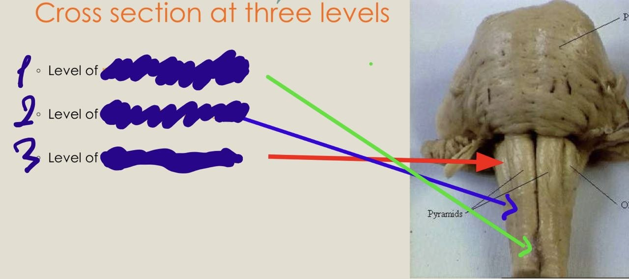 <p>identify levels of medulla</p>