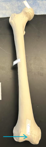 <p>ID femur feature</p>