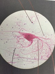 <p>Axon, thick pink appendage</p><p>Dendrite, thin pink appendage</p><p>Glial cells, black scattered dots</p>