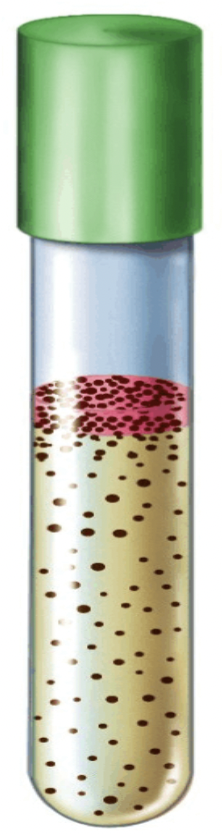 <p>Bacteria that are _________ _________ can grow with OR without oxygen, but they grow better with oxygen. So they will grow throughout the entire tube, with heavier growth in the oxygen layer.</p>